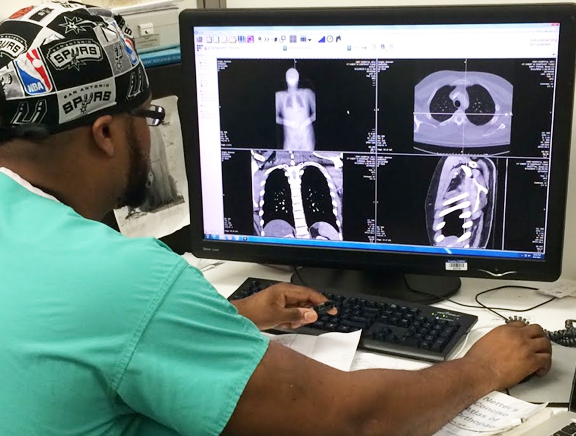 Orthopedic Specialist Doctor examining X-ray of a Patient's Ribcage.