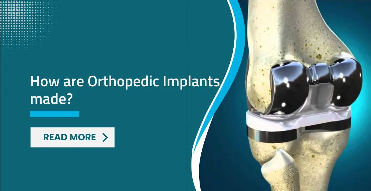 Science of Orthopedic Medical Implants