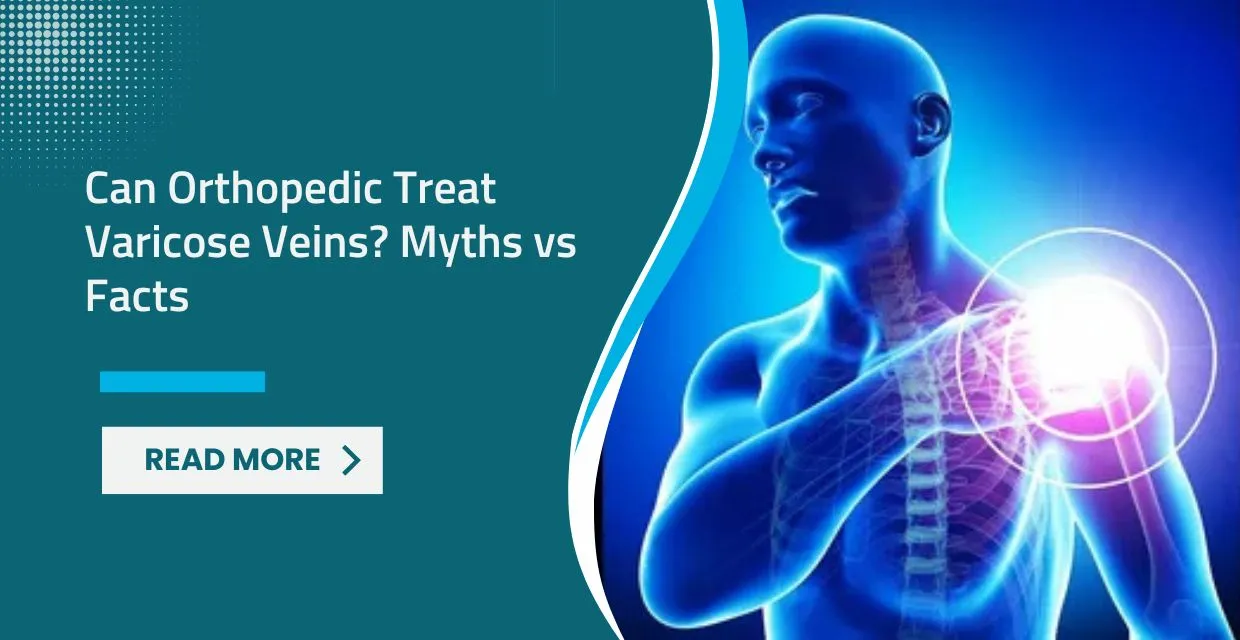 Orthopedic Surgeon or Vascular Surgeon for Veins