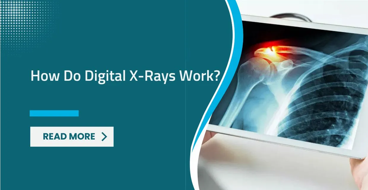 Science of Digital X-Ray Technology