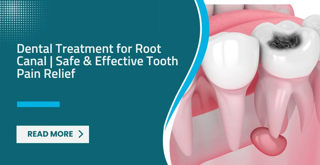 Diagnostic Imaging for Root Canal Therapy